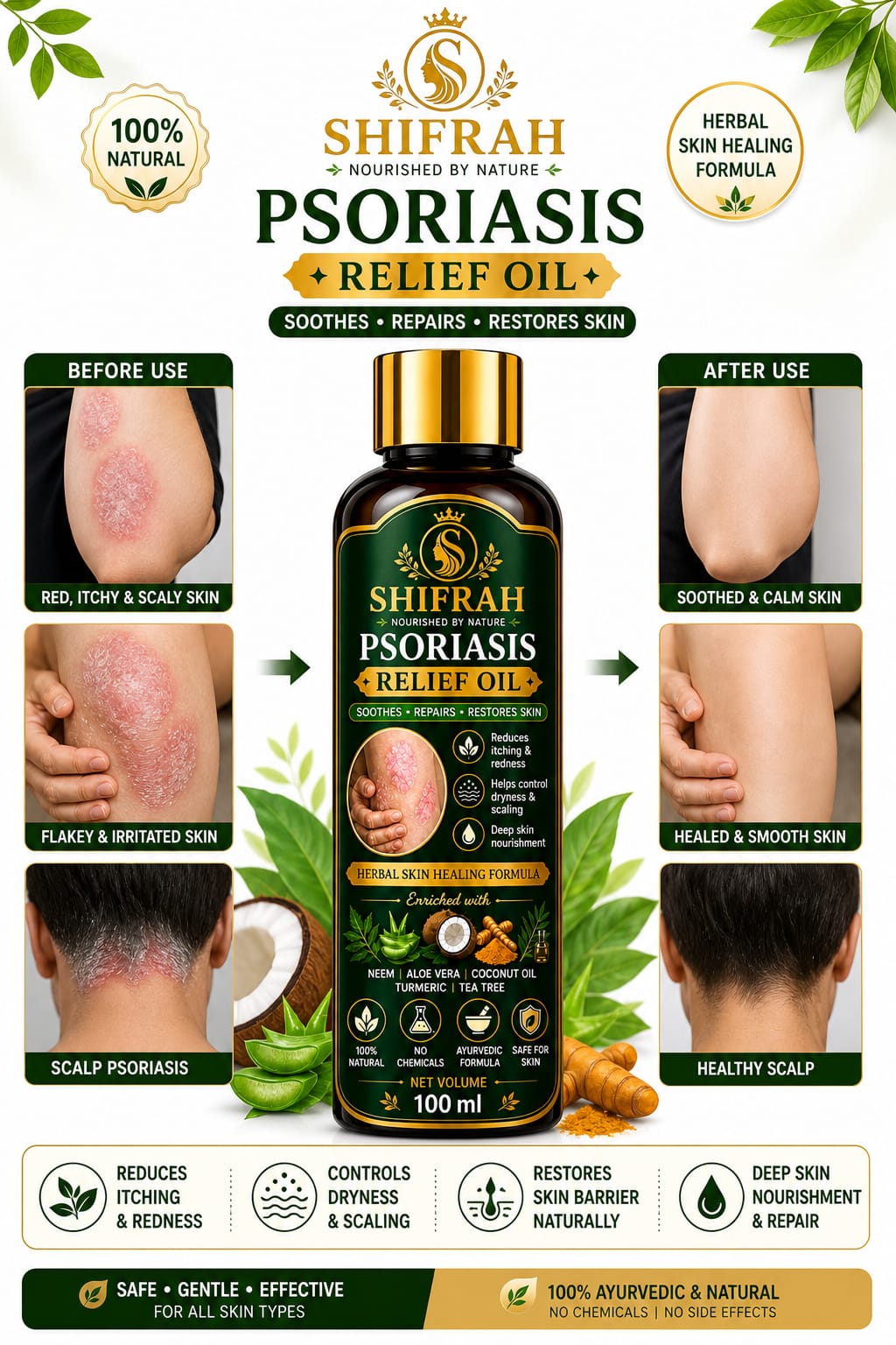 PSORIASIS OIL